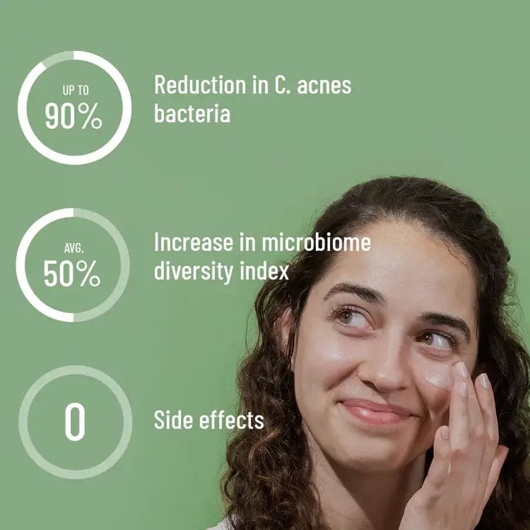 A healthcare provider using azelaic acid helps with dark patches from vitamin c and same active ingredients
